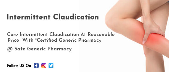 Intermittent Claudication