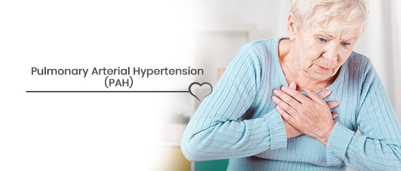 Pulmonary Arterial Hypertension (PAH)