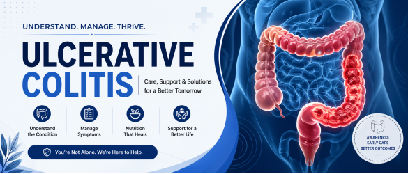 Ulcerative colitis colon inflammation symptoms and treatment